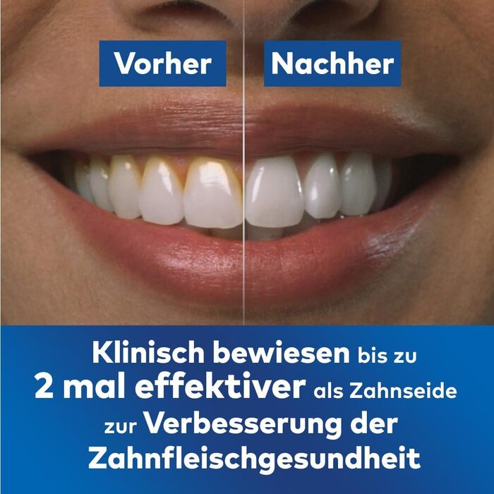 Waterpik Advanced Бездротова Іригатор для Ротової Порожнини, Іригатор для Зубів, Білий, 4 Насадки, 3 Режими, Індукційна Зарядка