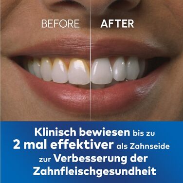 Waterpik Ultra Professional: Іригатор для порожнини рота, 6 насадок, 10 режимів, білий